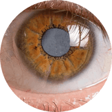 Occhio affetto da patologia della cornea, visita oculistica a Ferrara e Finale Emilia